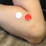 育児中の腱鞘炎には鍼 サポーターも湿布も効かず途方に暮れたママを救ったのは鍼 バイリンガルママライフ 育児中の腱鞘炎には鍼 サポーターも湿布も効かず途方に暮れたママを救ったのは鍼 バイリンガルママライフ